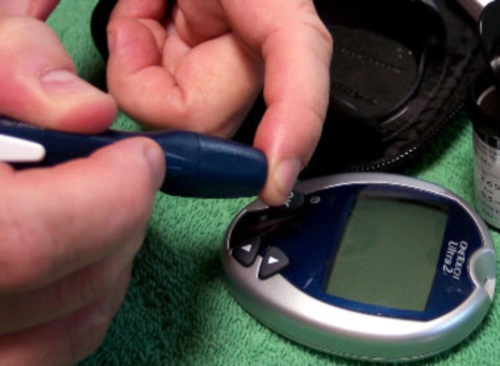 Consecuencias de la diabetes sobre la salud oral