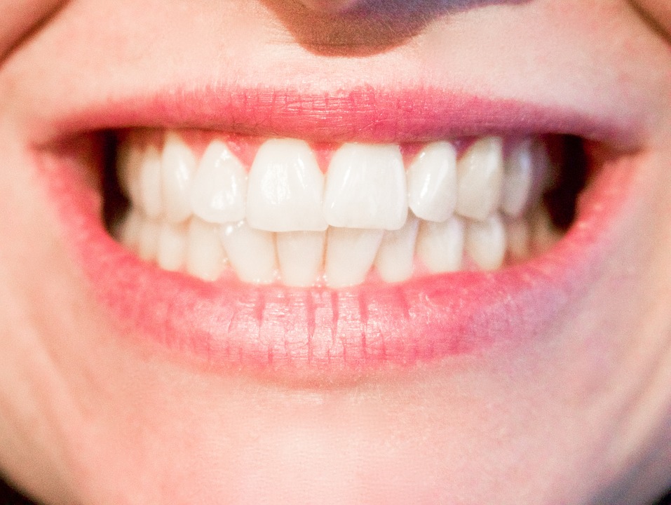 extraccion-de-piezas-dentales-durante-la-ortodoncia