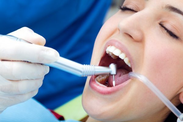 Implantes dentales en Madrid Centro