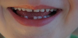 Los dientes de leche y la importancia de su cuidado
