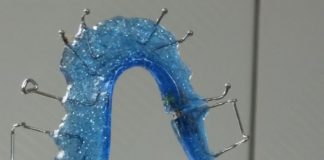 Todo lo que debes saber sobre la ortodoncia