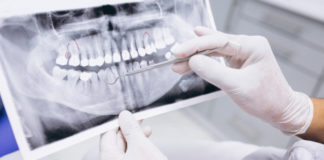 Radiografias dentales