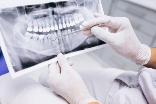 Radiografias dentales