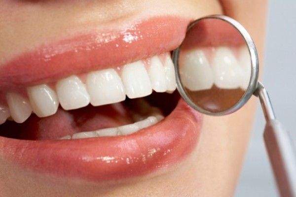 estetica-dental-dentistas-en-madrid