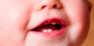 denticion-infantil
