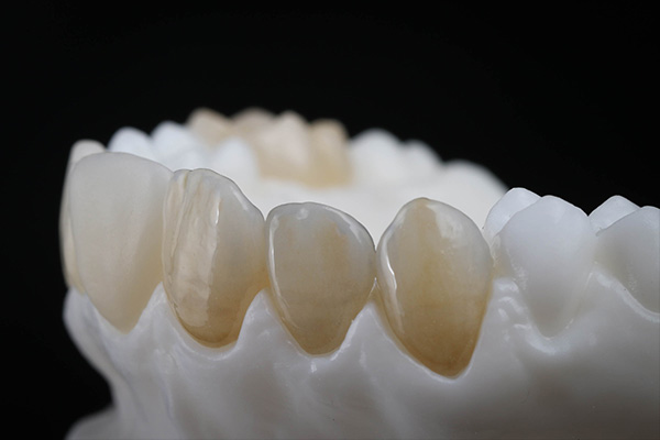resina dientes