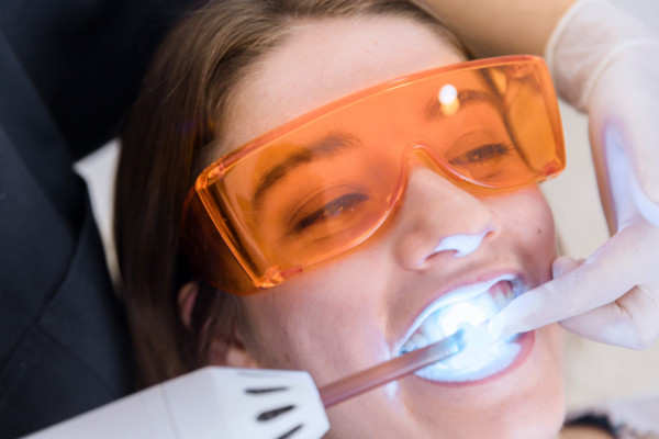 Blanqueamiento dental-Dentista en tu ciudad