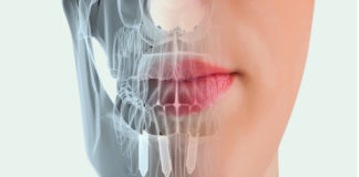 dentistas-en-madrid-implantes-dentales-clinica-dental-pilar-garrido2
