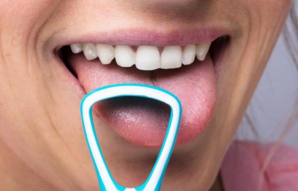 mal aliento-lengua-salud bucal