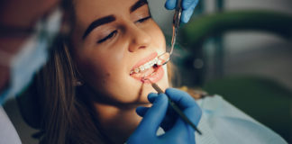¿Cómo elegir el mejor dentista?