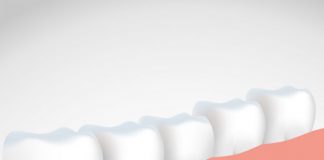 SEPA explica en qué casos son posibles los implantes tras perder el hueso por enfermedad periodontal