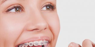 Todo lo que debes saber sobre la ortodoncia