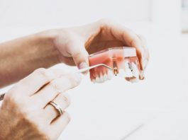 implantes-dentales-en-madrid-pilar-garrido-madrid-centro-dentistas-en-madrid