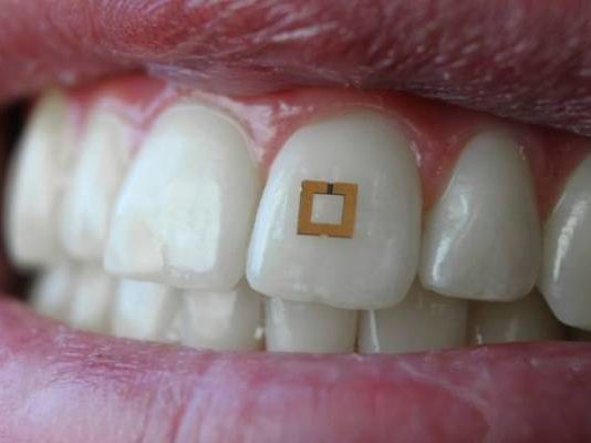 sensor dientes
