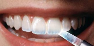 gel esmalte dental