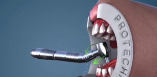 contaminacion cruzada dental