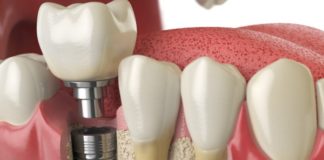 dentology