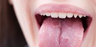 sintomas orales covid