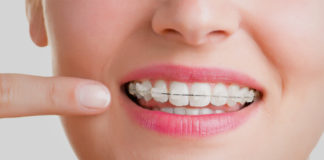 ortodoncia-estetica